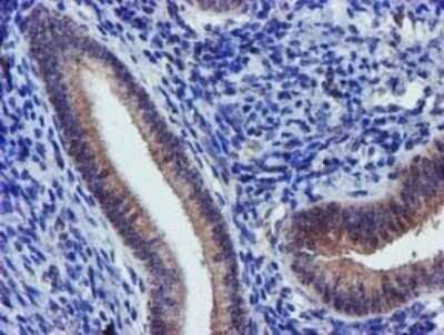 Immunohistochemistry: KvBeta1 Antibody (OTI7F12) - Azide and BSA Free [NBP2-71349] - Analysis of Human endometrium tissue. (Heat-induced epitope retrieval by 10mM citric buffer, pH6.0, 120C for 3min)