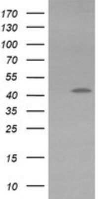 Western Blot: KvBeta1 Antibody (OTI7F12) - Azide and BSA Free [NBP2-71349] - Analysis of HEK293T cells were transfected with the pCMV6-ENTRY control (Left lane) or pCMV6-ENTRY KvBeta1.