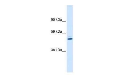 Western Blot: KvBeta1 Antibody [NBP2-86698] - WB Suggested Anti-KCNAB1 Antibody Titration: 0.2-1 ug/ml. ELISA Titer: 1:312500. Positive Control: Human kidney