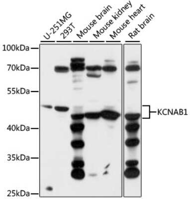 Western Blot: KvBeta1 Antibody [NBP3-03639] - Analysis of extracts of various cell lines, using KvBeta1 antibody at 1:1000 dilution. Secondary antibody: HRP Goat Anti-Rabbit IgG (H+L) at 1:10000 dilution. Lysates/proteins: 25ug per lane. Blocking buffer: 3% nonfat dry milk in TBST. Detection: ECL Basic Kit