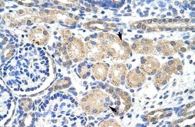 Immunohistochemistry: KvBeta2 Antibody [NBP1-80271] - Human Kidney Cellular data: Epithelial cells of renal tubule Antibody Concentration: 4.0-8.0 ug/ml Magnification: 400X.