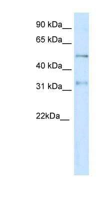 Western Blot: KvBeta2 Antibody [NBP1-80271] - KvBeta2 Antibody Titration: 0.2-1 ug/ml, Positive Control: Jurkat cell lysate.
