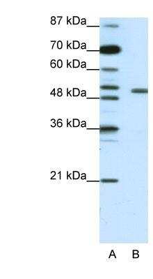 Western Blot: KvBeta2 Antibody [NBP1-80272] - Jurkat cell lysate, concentration 1.25ug/ml.