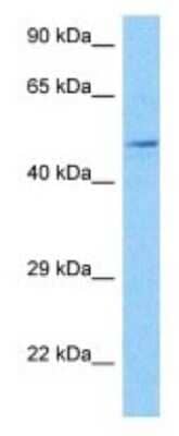 Western Blot: KvBeta2 Antibody [NBP3-09958] - Western blot analysis of KvBeta2 in MCF7 Whole Cell lysates. Antibody dilution at 1ug/ml
