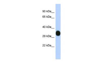 Western Blot: KvBeta2 Antibody [NBP3-10368] - Western blot analysis of KvBeta2 in Fetal Brain lysates. Antibody dilution at 1.0ug/ml