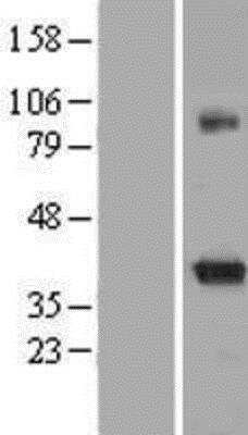 Western Blot: KvBeta2 Overexpression Lysate (Native) [NBP2-05196] - KvBeta2 Overexpression Lysate (Native) Left-Empty vector transfected control cell lysate (HEK293 cell lysate); Right -Over-expression Lysate for KCNAB2.