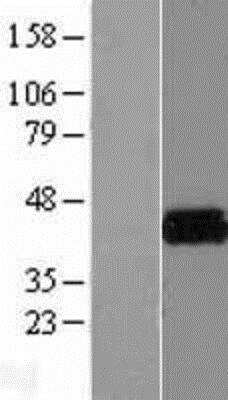Western Blot: KvBeta2 Overexpression Lysate (Native) [NBP2-07973] - KvBeta2 Overexpression Lysate (Native) Left-Empty vector transfected control cell lysate (HEK293 cell lysate); Right -Over-expression Lysate for KCNAB2.