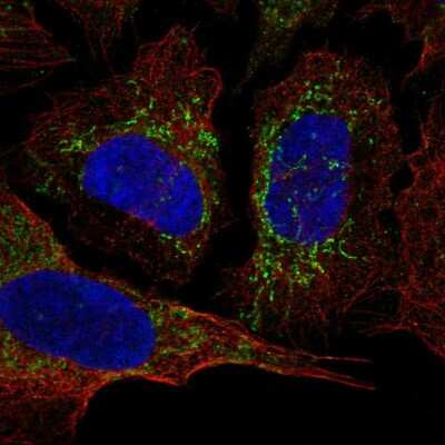 Immunocytochemistry/ Immunofluorescence KvBeta3 Antibody - BSA Free