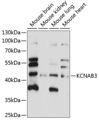 Western Blot: KvBeta3 Antibody [NBP3-03643] - Analysis of extracts of various cell lines, using KvBeta3 antibody at 1:1000 dilution. Secondary antibody: HRP Goat Anti-Rabbit IgG (H+L) at 1:10000 dilution. Lysates/proteins: 25ug per lane. Blocking buffer: 3% nonfat dry milk in TBST. Detection: ECL Enhanced Kit.