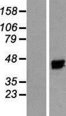 Western Blot: KvBeta3 Overexpression Lysate (Native) [NBP2-07834] - KvBeta3 Overexpression Lysate (Native) Left-Empty vector transfected control cell lysate (HEK293 cell lysate); Right -Over-expression Lysate for KCNAB3.
