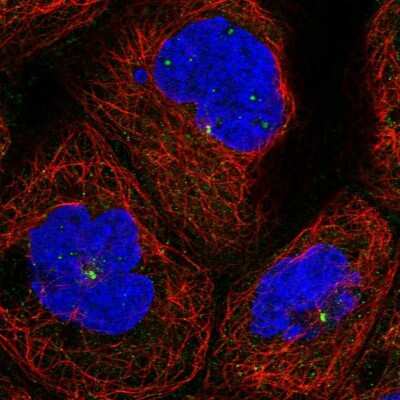 Immunocytochemistry/Immunofluorescence: KxDL motif containing 1 Antibody [NBP1-82056] - Immunofluorescent staining of human cell line A-431 shows localization to nucleoli fibrillar center, cytosol & centrosome.