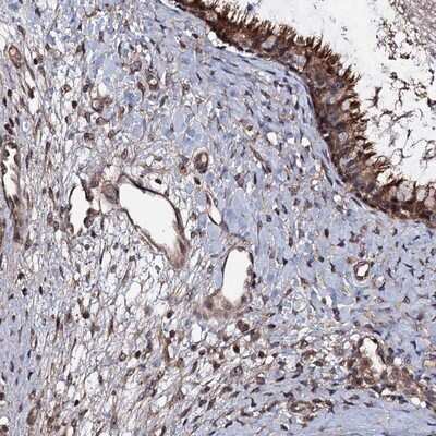 Immunohistochemistry-Paraffin: KxDL motif containing 1 Antibody [NBP1-82056] - Staining of human nasopharynx shows cytoplasmic positivity.