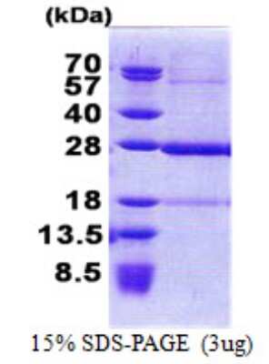 SDS-PAGE Recombinant Human KxDL motif containing 1 His Protein