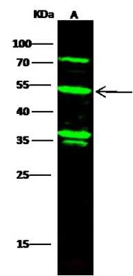 Western Blot: Kynureninase Antibody (004) [NBP2-90525] - Anti-Kynureninase rabbit monoclonal antibody at 1:500 dilution. Lane A: NCI-H460 Whole Cell Lysate. Lysates/proteins at 30 ug per lane. Secondary Goat Anti-Rabbit IgG H&L (Dylight 800) at 1/10000 dilution. Developed using the Odyssey technique. Performed under reducing conditions. Predicted band size: 52 kDa. Observed band size: 52 kDa (We are unsure as to the identity of these extra bands).