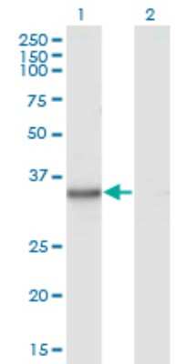 Western Blot: Kynureninase Antibody (1G2) [H00008942-M02] - Analysis of KYNU expression in transfected 293T cell line by KYNU monoclonal antibody (M02), clone 1G2.Lane 1: KYNU transfected lysate (Predicted MW: 34.6 KDa).Lane 2: Non-transfected lysate.