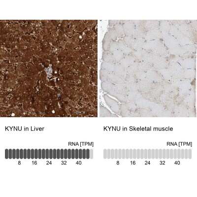 <b>Orthogonal Strategies Validation. </b>Immunohistochemistry-Paraffin: Kynureninase Antibody [NBP2-14180] - Staining in human liver and skeletal muscle tissues using anti-KYNU antibody. Corresponding KYNU RNA-seq data are presented for the same tissues.