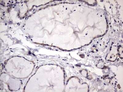 Immunohistochemistry: Kynureninase Antibody (OTI1H1) - Azide and BSA Free [NBP2-71400] - Analysis of Human thyroid tissue.