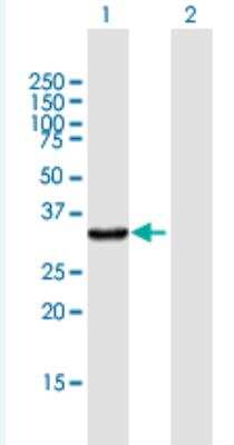 Western Blot: Kynureninase Antibody [H00008942-B01P-50ug] - Analysis of KYNU expression in transfected 293T cell line (H00008942-T01) by KYNU MaxPab polyclonal antibody.  Lane 1: KYNU transfected lysate(33.77 KDa). Lane 2: Non-transfected lysate.