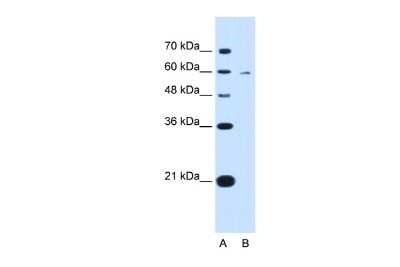 Western Blot: Kynureninase Antibody [NBP1-56545] - Antibody  Titration: 0.2-1 ug/ml ELISA Titer: 1 : 312500 Positive control: HepG2 cell lysate KYNU is supported by BioGPS gene expression data to be expressed in HepG2.