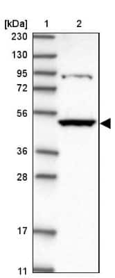 Western Blot: Kynureninase Antibody [NBP2-14180] - Lane 1: Marker  [kDa] 230, 130, 95, 72, 56, 36, 28, 17, 11.  Lane 2: Human cell line RT-308