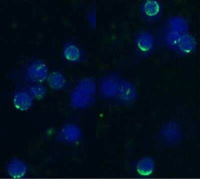 Immunocytochemistry: L-Selectin/CD62L Antibody (IVA94) [NB500-497] - Staining of acetone/methanol fixed bovine peripheral blood (lymphocyte-enriched suspension) using anti-bovine CD62L (IVA94); secondary antibody conjugated to FITC (green), DNA stained with DAPI (blue).