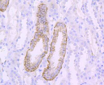 Immunohistochemistry-Paraffin: L1CAM Antibody (JM11-05) [NBP2-66921] - Analysis of paraffin-embedded human kidney tissue using anti-L1CAM antibody. Counter stained with hematoxylin.