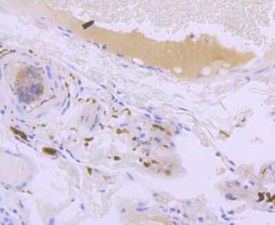 Immunohistochemistry-Paraffin: L1CAM Antibody (JM11-05) [NBP2-66921] - Analysis of paraffin-embedded human thyroid tissue using anti-L1CAM antibody. Counter stained with hematoxylin.