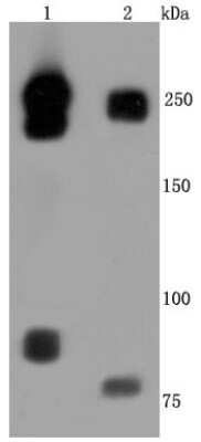 Western Blot: L1CAM Antibody (JM11-05) [NBP2-66921] - Analysis of L1CAM on different cells lysates using anti-L1CAM antibody at 1/500 dilution. Positive control: Line 1: Hela Line 2: human brain