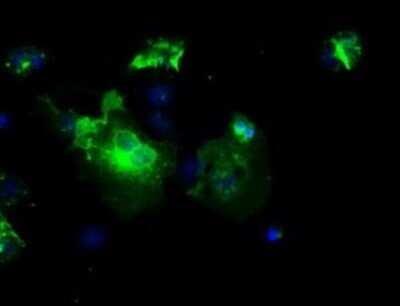 Immunocytochemistry/Immunofluorescence: L1CAM Antibody (OTI2A6) - Azide and BSA Free [NBP2-71097] - Staining of COS7 cells transiently transfected by pCMV6-ENTRY L1CAM.