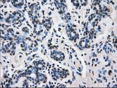 Immunohistochemistry: L1CAM Antibody (OTI2A6) - Azide and BSA Free [NBP2-71097] - Staining of paraffin-embedded breast tissue using anti-L1CAM mouse monoclonal antibody.