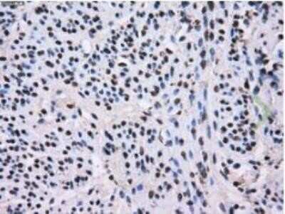 Immunohistochemistry: L1CAM Antibody (OTI2A6) - Azide and BSA Free [NBP2-71097] - Staining of paraffin-embedded endometrium tissue within the normal limits using anti-L1CAM mouse monoclonal antibody. Heat-induced epitope retrieval by 10mM citric buffer, pH6.0, 100C for 10min.