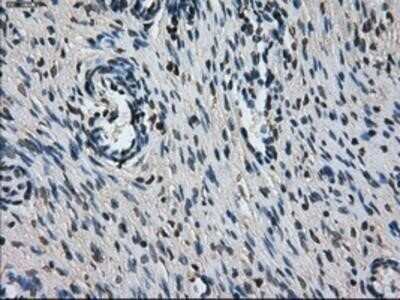 Immunohistochemistry: L1CAM Antibody (OTI2A6) - Azide and BSA Free [NBP2-71097] - Staining of paraffin-embedded Ovary tissue using anti-L1CAM mouse monoclonal antibody.