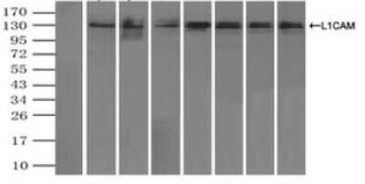 Immunoprecipitation: L1CAM Antibody (OTI2A6) - Azide and BSA Free [NBP2-71097] - Immunoprecipitation of L1CAM by using a monoclonal anti-L1CAM antibody (Negative control: IP without adding anti-L1CAM antibody). For each experiment, 500ul of DDK tagged L1CAM overexpression lysates (at 1:5 dilution with HEK293T lysate), 2ug of anti-L1CAM antibody and 20ul (0.1mg) of goat anti-mouse conjugated magnetic beads were mixed and incubated overnight. After extensive wash to remove any non-specific binding, the immuno-precipitated products were analyzed with rabbit anti-DDK polyclonal antibody.