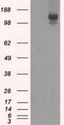 Western Blot: L1CAM Antibody (OTI2A6) - Azide and BSA Free [NBP2-71097] - HEK293T cells were transfected with the pCMV6-ENTRY control (Left lane) or pCMV6-ENTRY L1CAM (Right lane) cDNA for 48 hrs and lysed. Equivalent amounts of cell lysates (5 ug per lane) were separated by SDS-PAGE and immunoblotted with anti-L1CAM.