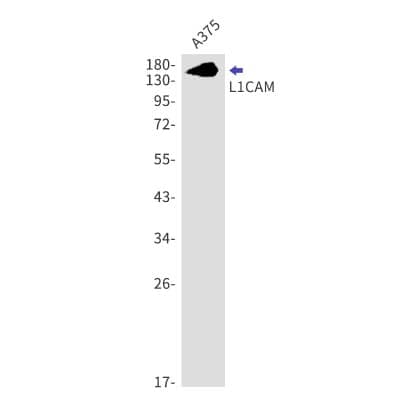 Western Blot: L1CAM Antibody (S04-8I3) [NBP3-20043] - Western blot detection of L1CAM in A375 using NBP3-20043. Predicted band size: 140kDa. Observed band size: 140kDa.