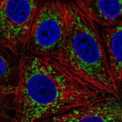 Immunocytochemistry/Immunofluorescence: L2HGDH Antibody [NBP2-49445] - Immunofluorescent staining of human cell line MCF7 shows localization to mitochondria.