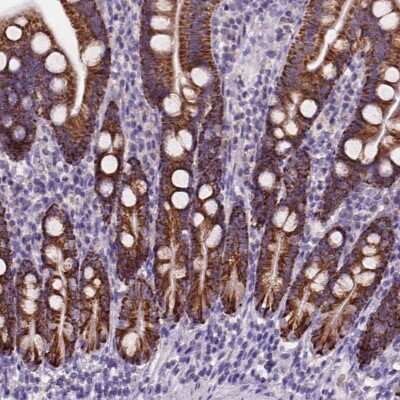 Immunohistochemistry-Paraffin: L2HGDH Antibody [NBP2-49445] - Staining of human duodenum shows strong positivity with a granular a pattern in glandular cells.