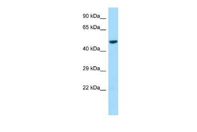 Western Blot: L2HGDH Antibody [NBP2-85197] - Host: Rabbit. Target Name: L2HGDH. Sample Type: HepG2 Whole Cell lysates. Antibody Dilution: 1.0ug/ml