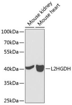 Western Blot: L2HGDH Antibody [NBP3-04541] - Analysis of extracts of various cell lines, using L2HGDH antibody at 1:1000 dilution. Secondary antibody: HRP Goat Anti-Rabbit IgG (H+L) at 1:10000 dilution. Lysates/proteins: 25ug per lane. Blocking buffer: 3% nonfat dry milk in TBST. Detection: ECL Basic Kit