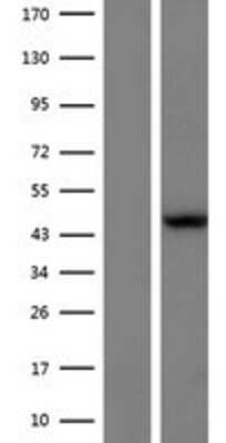 Western Blot: L2HGDH Overexpression Lysate (Adult Normal) [NBP2-06265] Left-Empty vector transfected control cell lysate (HEK293 cell lysate); Right -Over-expression Lysate for L2HGDH.