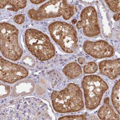 Immunohistochemistry-Paraffin: L3HYPDH Antibody [NBP2-31648] - Staining of human kidney shows strong cytoplasmic positivity in cells in tubules.