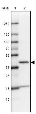 Western Blot: L3HYPDH Antibody [NBP2-31648] - Lane 1: Marker [kDa] 250, 130, 100, 70, 55, 35, 25, 15, 10Lane 2: Human cell line U-87 MG