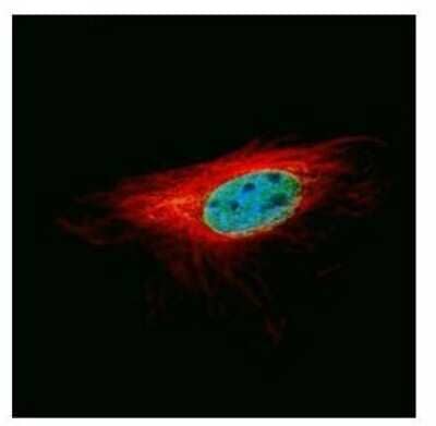 Immunocytochemistry/Immunofluorescence: L3MBTL1 Antibody [NBP2-19317] - Confocal immunofluorescence analysis of paraformaldehyde-fixed HeLa, using L3MBTL antibody (Green) at 1:500 dilution. Alpha-tubulin filaments are labeled with Alpha-tubulin antibody (Red) at 1:2000.