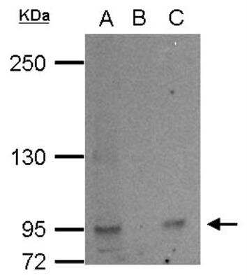 Western Blot L3MBTL2 Antibody