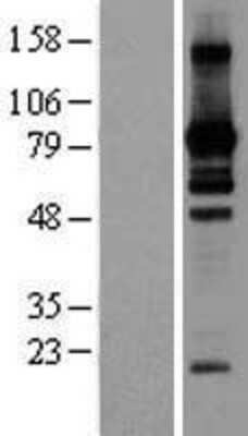Western Blot: L3MBTL2 Overexpression Lysate (Adult Normal) [NBP2-06118] Left-Empty vector transfected control cell lysate (HEK293 cell lysate); Right -Over-expression Lysate for L3MBTL2.