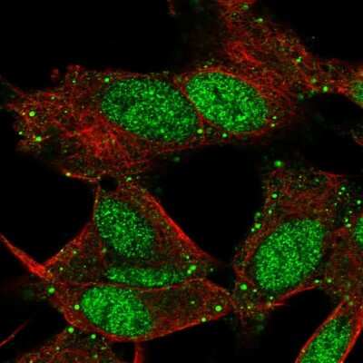 Immunocytochemistry/Immunofluorescence: L3MBTL4 Antibody [NBP2-56598] - Staining of human cell line SH-SY5Y shows localization to nucleoplasm & vesicles.