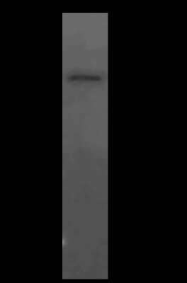 Immunoprecipitation: LACC1 Antibody [NBP2-99134] - LACC1 was immunoprecipitated using: Lane A: 0.5 mg Jurkat Whole Cell Lysate4 ul anti-LACC1 rabbit polyclonal antibody and 15 ul of 50 % Protein G agarose. Primary antibody: Anti-LACC1 rabbit polyclonal antibody, at 1:100 dilution. Secondary antibody: Clean-Bloto IP Detection Reagent (HRP) at 1:500 dilution. Developed using the DAB staining technique. Performed under reducing conditions. Predicted band size: 47 kDa. Observed band size: 47 kDa