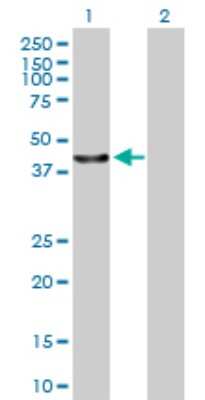 Western Blot: LACC1 Antibody [H00144811-B01P] - Analysis of C13orf31 expression in transfected 293T cell line by C13orf31 polyclonal antibody.  Lane 1: FLJ38725 transfected lysate(47.3 KDa). Lane 2: Non-transfected lysate.