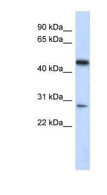 Western Blot: LACC1 Antibody [NBP1-56736] - Human Lung lysate, concentration 0.2-1 ug/ml.