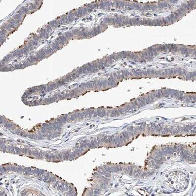 Immunohistochemistry-Paraffin: LACE1 Antibody [NBP1-89215] - Staining of human fallopian tube shows strong positivity in ciliated cells.